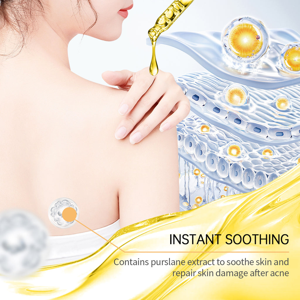 Clarifying Acne Skin Care Set